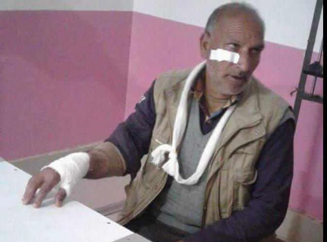 Forest official hurt in attack by timber smugglers